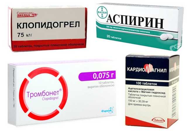 Ацетилсалициловая кислота: есть ли смысл применять аспирин для профилактики?